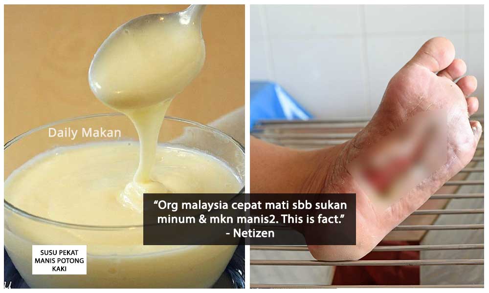 susu pekat manis bahaya