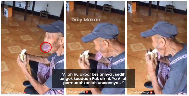 sukar untuk makan kerana tumor