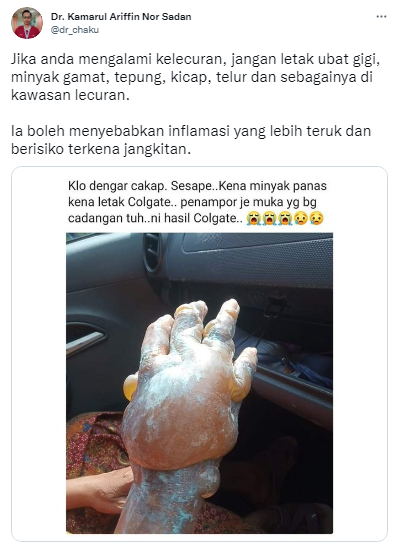 MINYAK PANAS