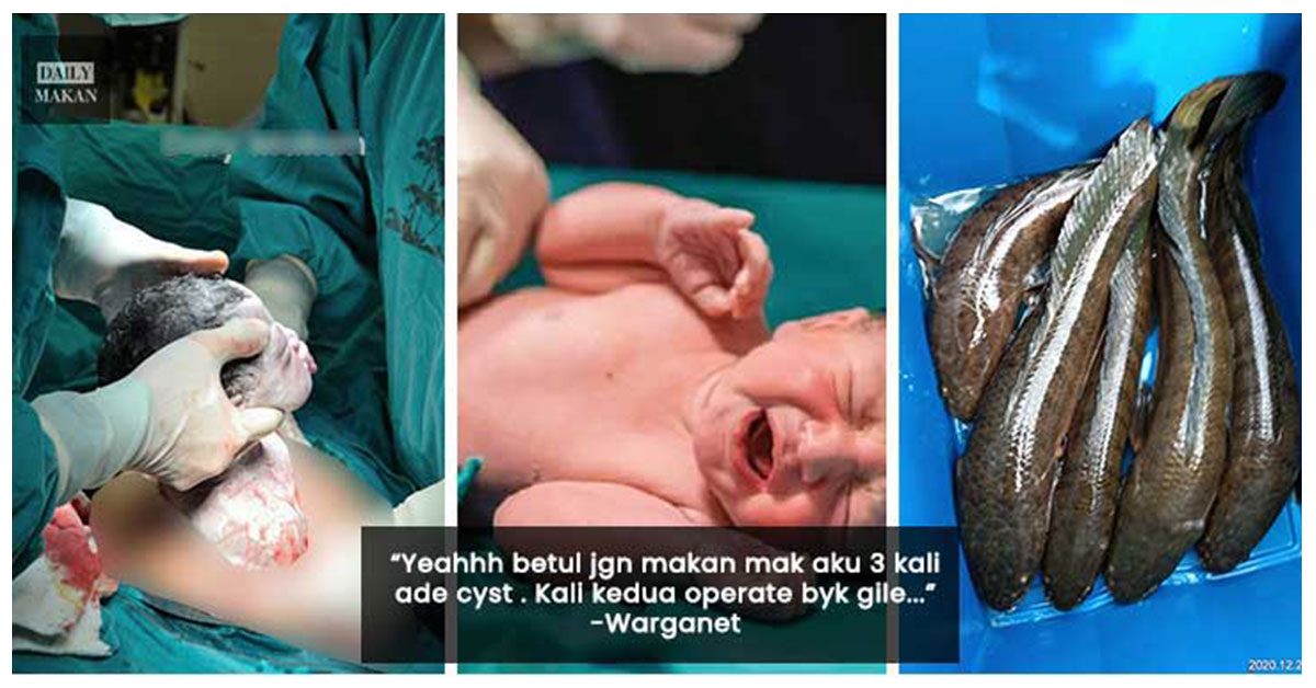 makan ikan haruan bagus untuk ibu