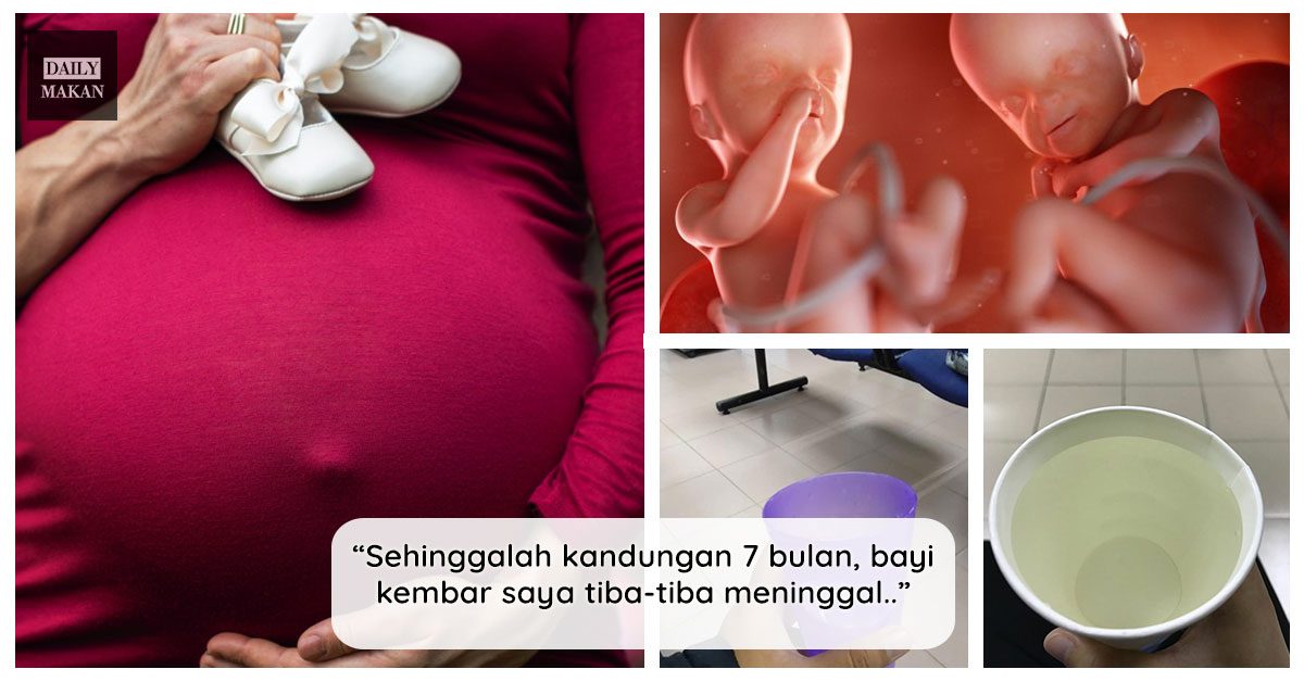 ibu muntahkan air gula