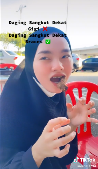 Daging Sangkut Di Braces