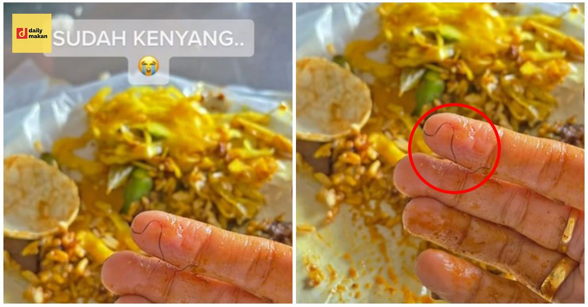 temui bulu dalam nasi kandar